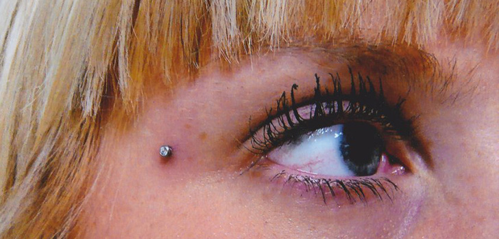 Mikrodermal piercing: jak powstają mikrodermabry (zdjęcia)