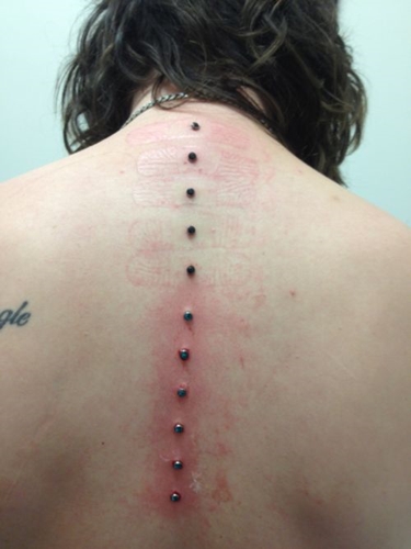 Mikrodermal piercing: jak powstają mikrodermabry (zdjęcia)