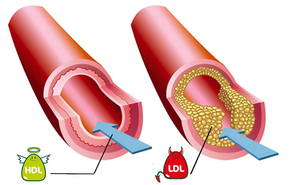 Cholesterol: mity, prawda i zalecenia dietetyków