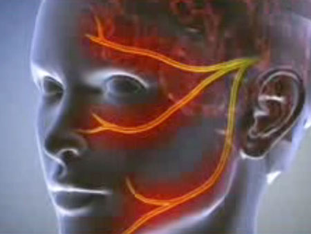 Neuralgia: objawy, zdjęcia, leczenie